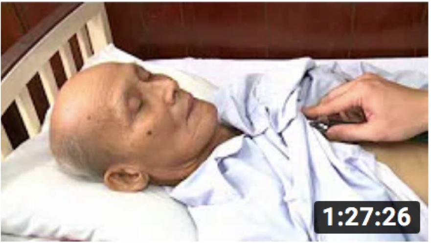 Những điều cần biết về loãng xương