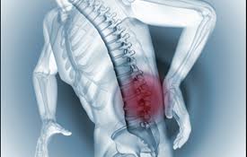 Hãy chú ý các dấu hiệu gãy xương cột sống